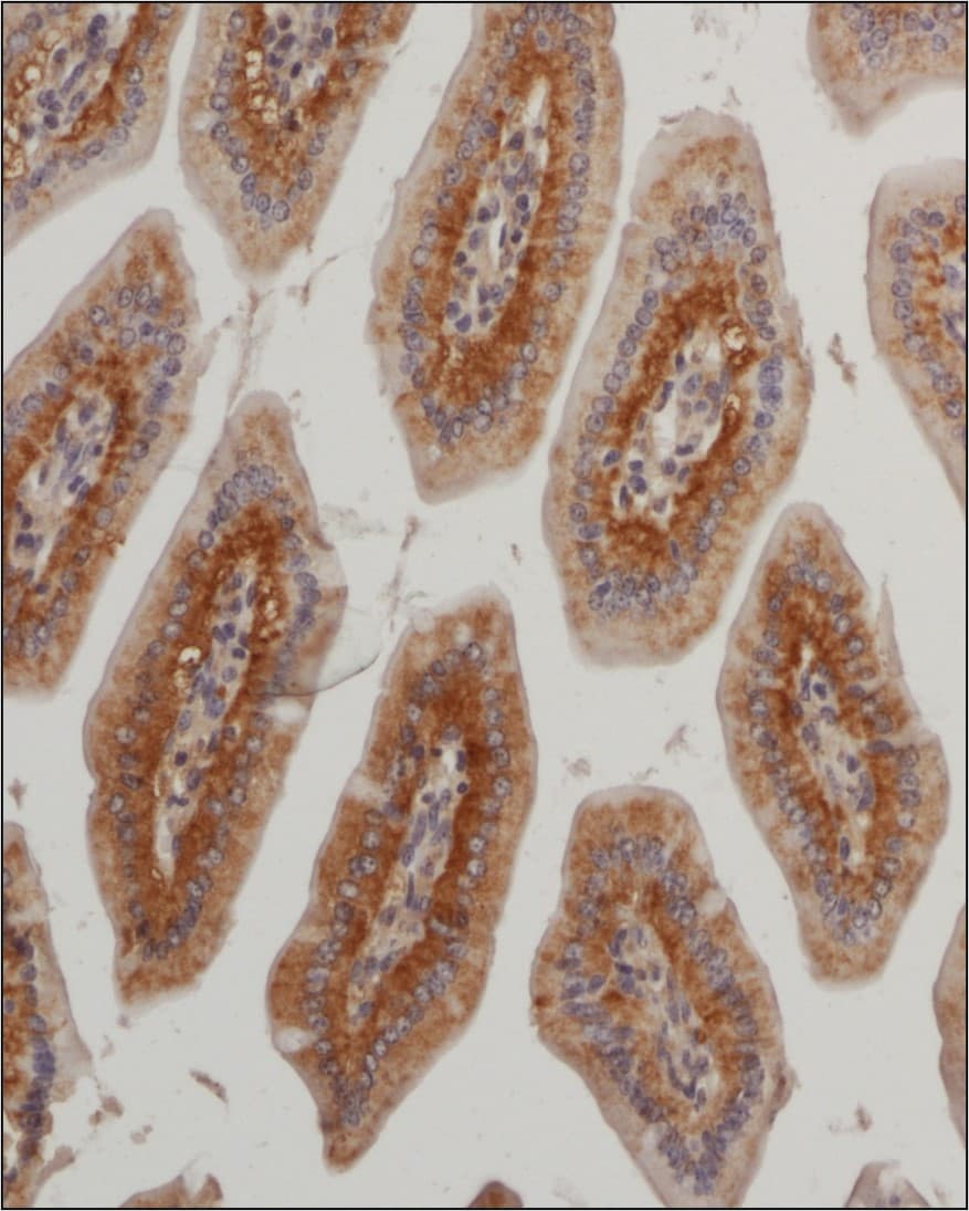 Glut4 Antibody - BSA Free Glut4 Antibody - BSA Free Immunohistochemistry: Glut4 Antibody - BSA Free [NBP1-49533]