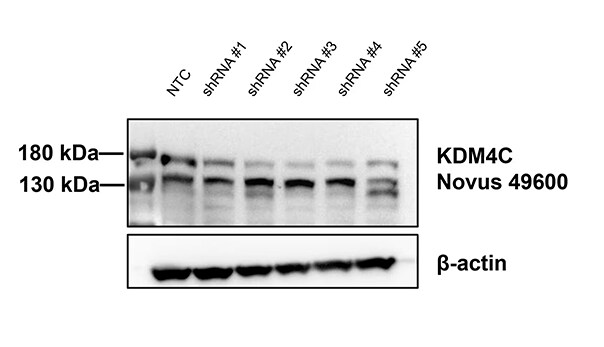 Lysine (K)-specific Demethylase 4C/KDM4C/JMJD2C Antibody - BSA Free
