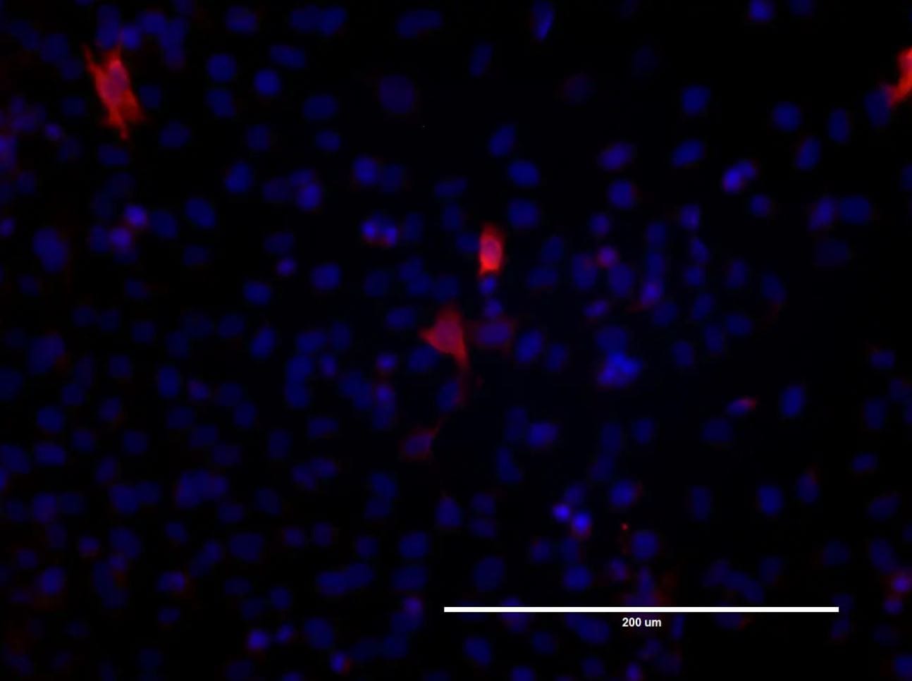 Gigaxonin Antibody