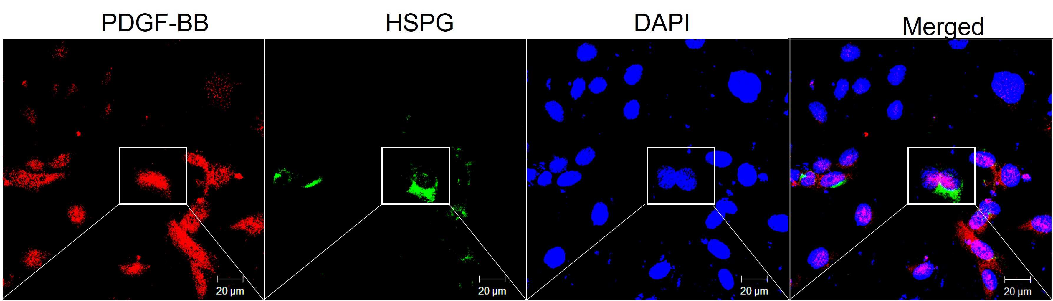 PDGF-B Antibody