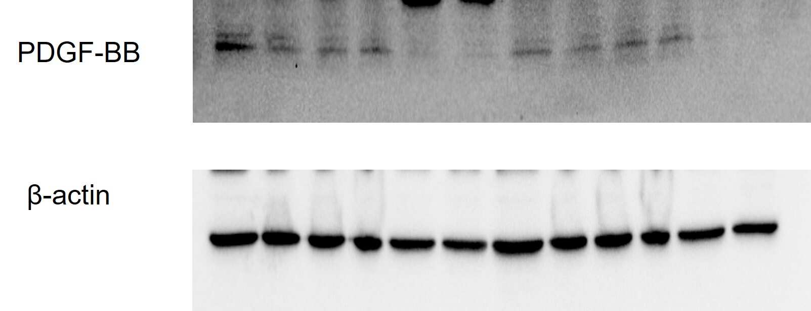 PDGF-B Antibody