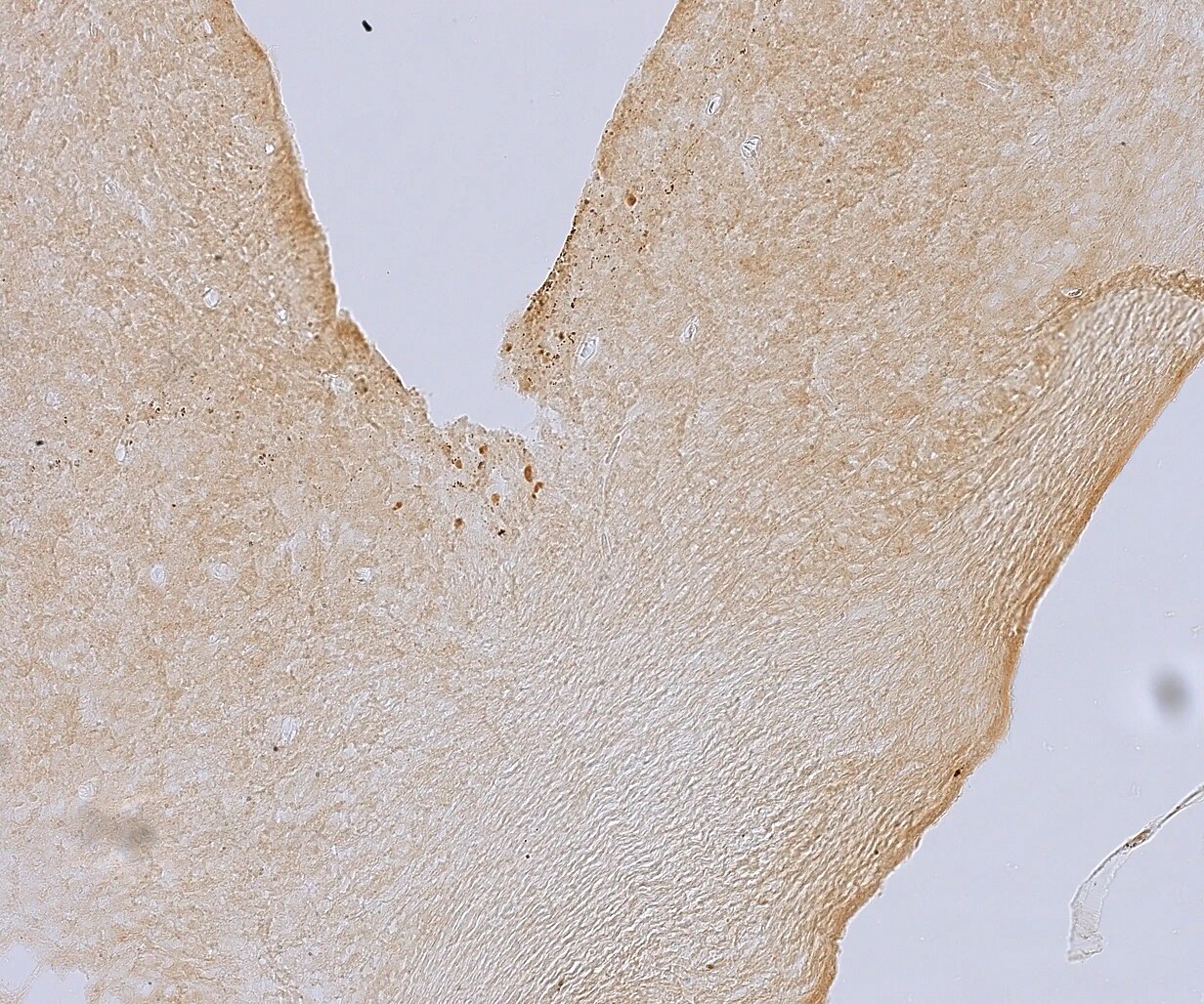 CRY1 Antibody