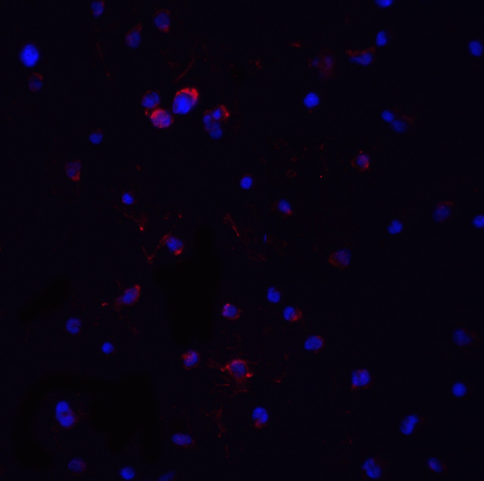 MyD88 Antibody - BSA Free