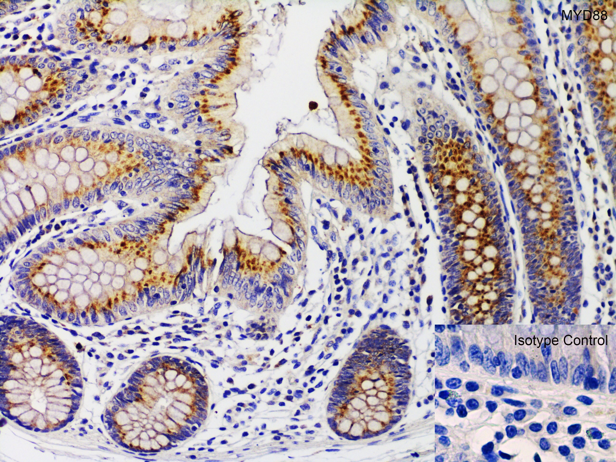 MyD88 Antibody - BSA Free