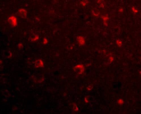 SLITRK6 Antibody - BSA Free
