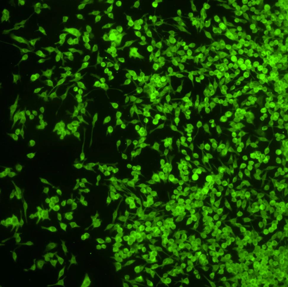 IFN-beta Antibody