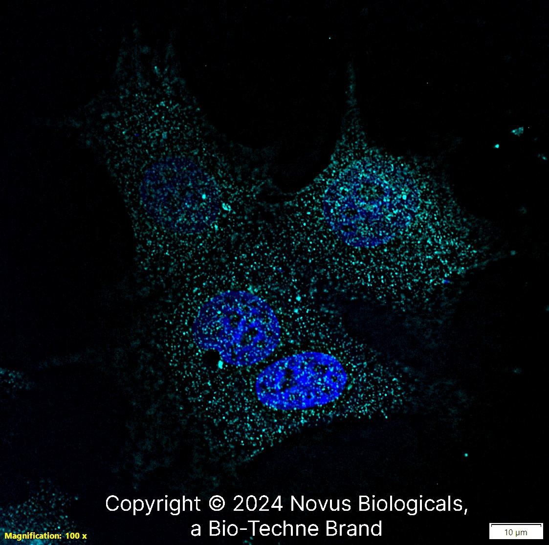 PIEZO1 Antibody - BSA Free