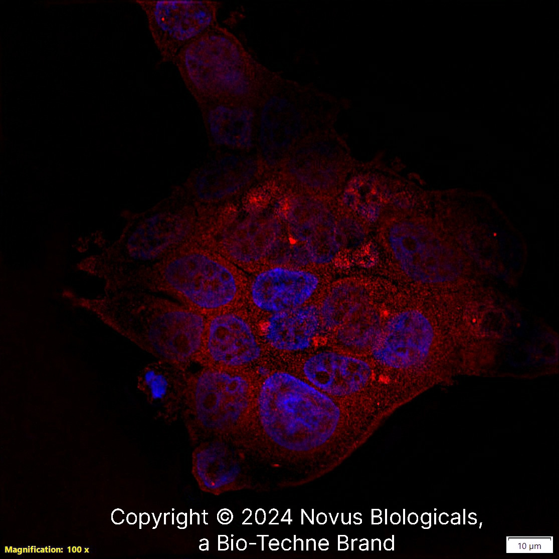 PIEZO1 Antibody - BSA Free