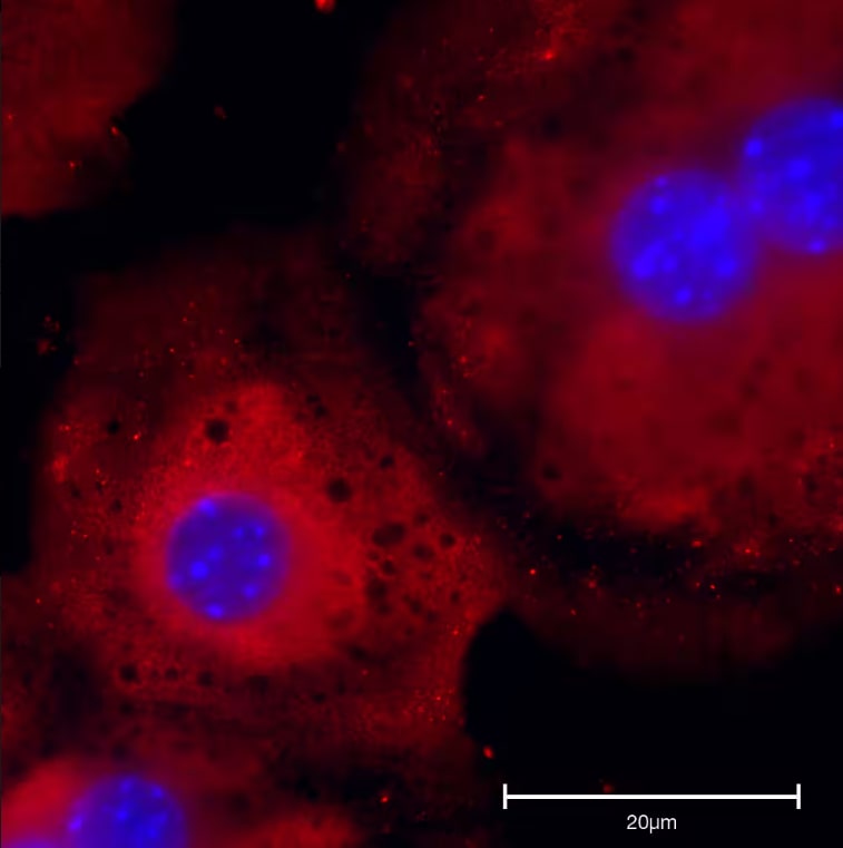 TGF-beta 1 Antibody