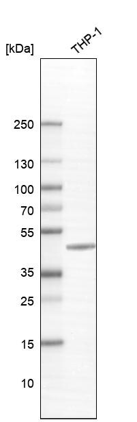 TYKi Antibody Western Blot: TYKi Antibody [NBP1-80653]