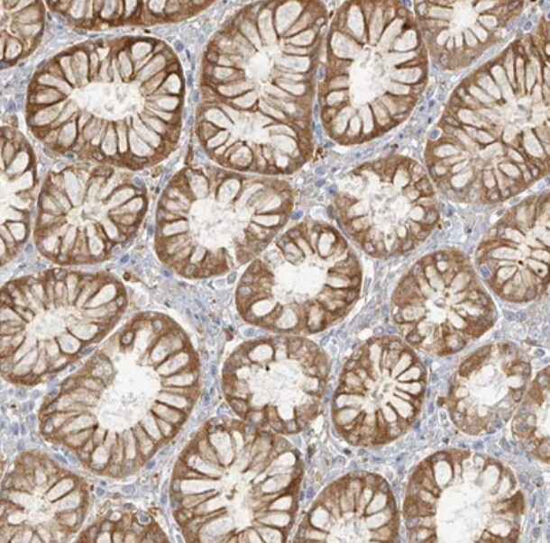 Uroplakin Ib Antibody - BSA Free