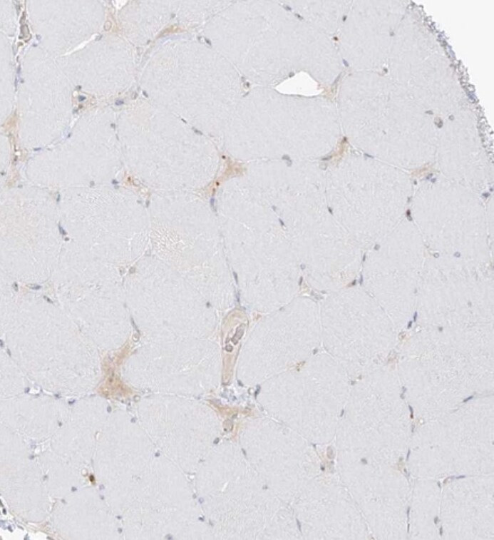 Uroplakin Ib Antibody - BSA Free