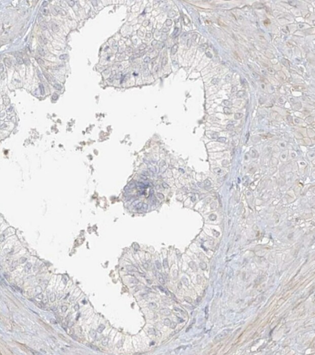 Uroplakin Ib Antibody - BSA Free