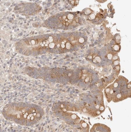 PHLDA3 Antibody