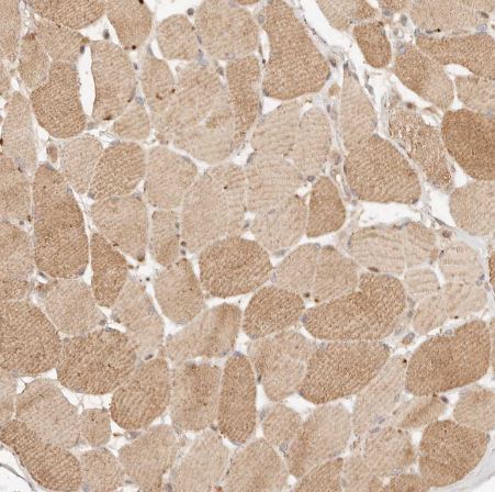 PHLDA3 Antibody