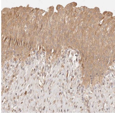 PHLDA3 Antibody