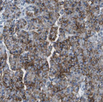 SLC16A10 Antibody