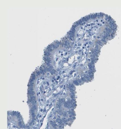 SLC16A10 Antibody
