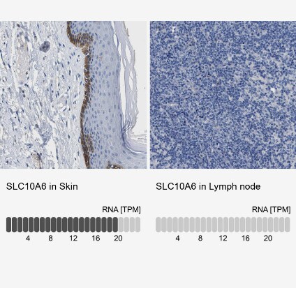 SLC10A6 Antibody