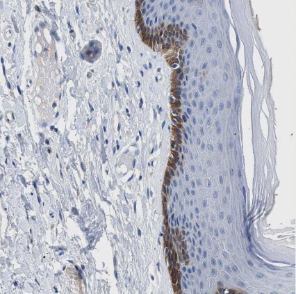 SLC10A6 Antibody