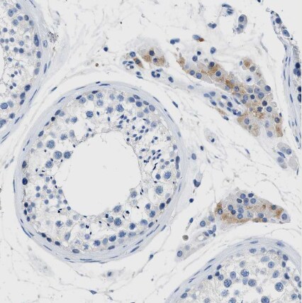 SLC10A6 Antibody