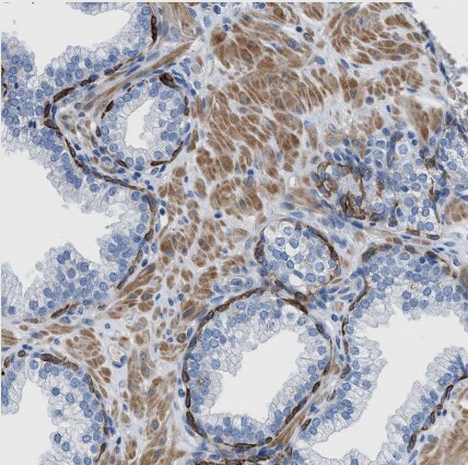 SLC10A6 Antibody