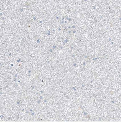 Serine protease 23 Antibody