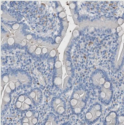 Serine protease 23 Antibody