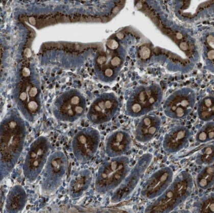 TMEM115 Antibody - BSA Free