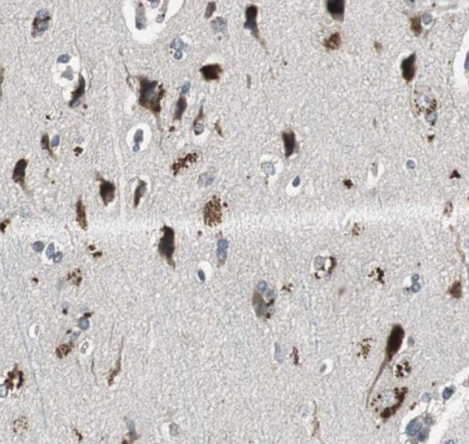 PI4KB/PI4KIII beta Antibody - BSA Free