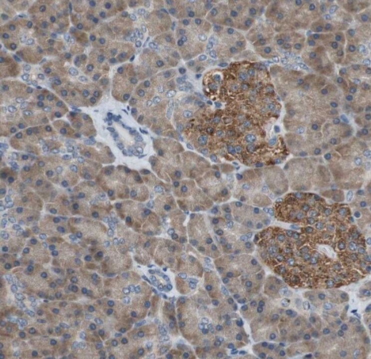 PI4KB/PI4KIII beta Antibody - BSA Free