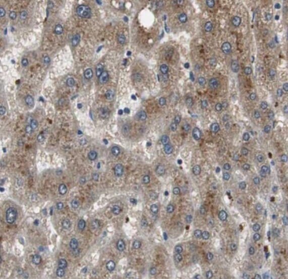 PI4KB/PI4KIII beta Antibody - BSA Free