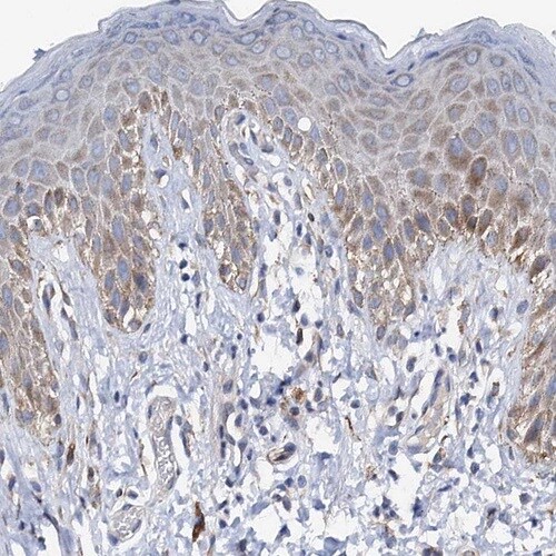 PAMCI Antibody - BSA Free Immunohistochemistry: PAMCI Antibody [NBP1-80938]