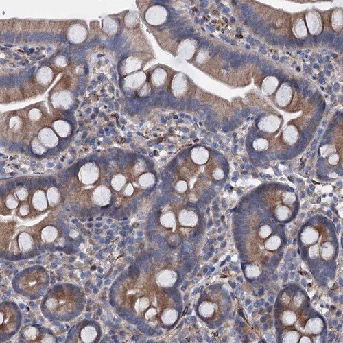 PAMCI Antibody - BSA Free Immunohistochemistry: PAMCI Antibody [NBP1-80938]