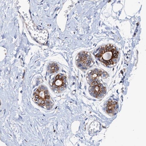 PAMCI Antibody - BSA Free Immunohistochemistry: PAMCI Antibody [NBP1-80938]