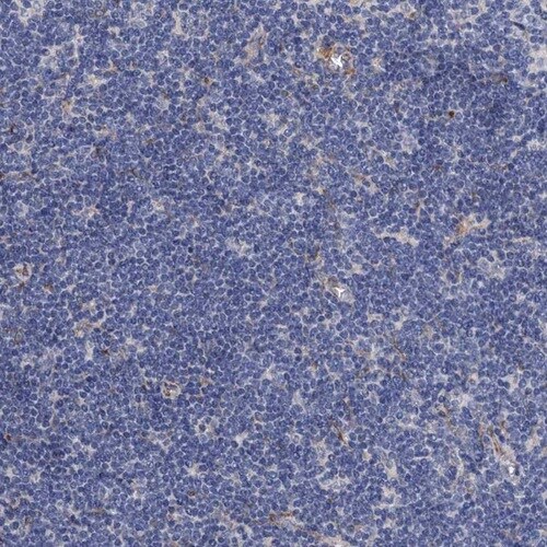 PAMCI Antibody - BSA Free Immunohistochemistry: PAMCI Antibody [NBP1-80938]