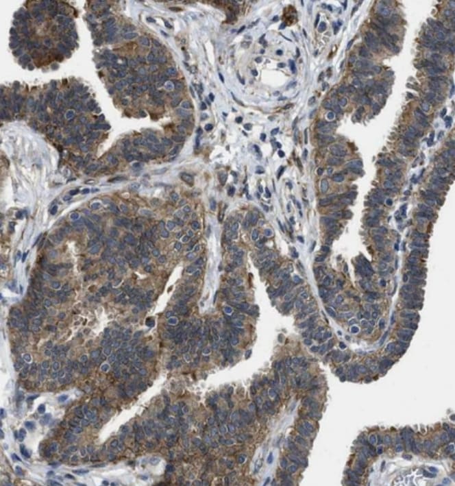 Polycystin 2 Antibody - BSA Free
