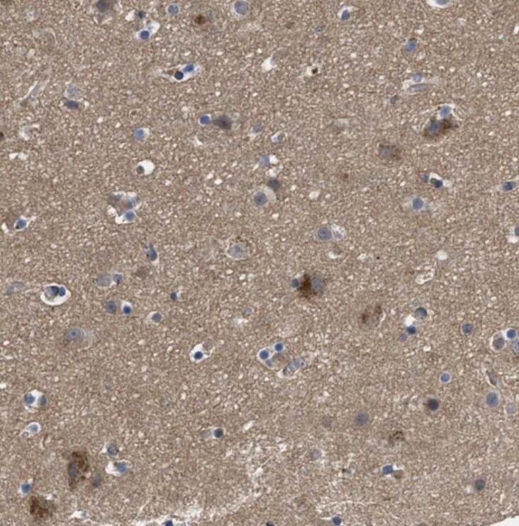 Polycystin 2 Antibody - BSA Free