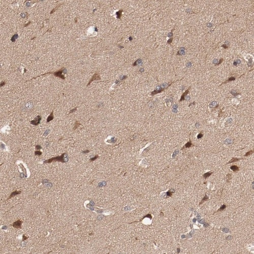 PITPNM2 Antibody - BSA Free Immunohistochemistry-Paraffin: PITPNM2 Antibody [NBP1-80995]