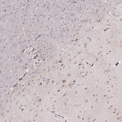 EGR4 Antibody - BSA Free Immunohistochemistry-Paraffin: EGR4 Antibody [NBP1-80999]