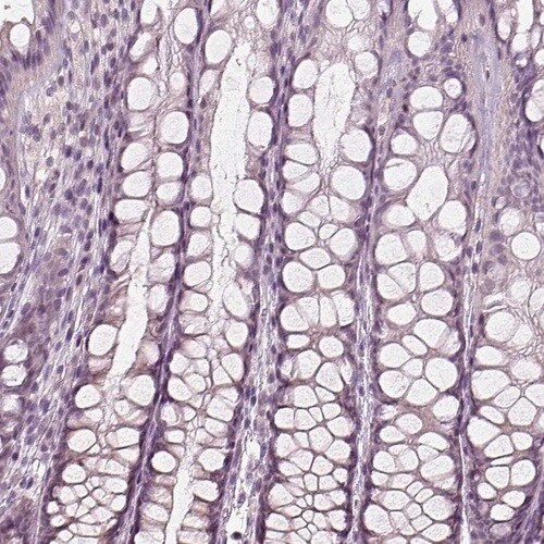 EGR4 Antibody - BSA Free Immunohistochemistry-Paraffin: EGR4 Antibody [NBP1-80999