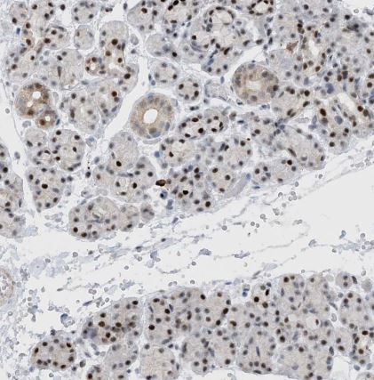 HEMK1 Antibody