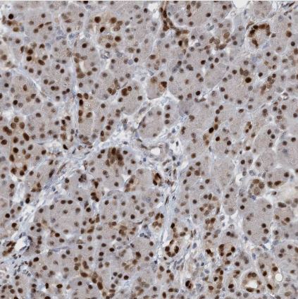 HEMK1 Antibody