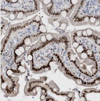 HEMK1 Antibody