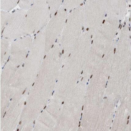 HEMK1 Antibody
