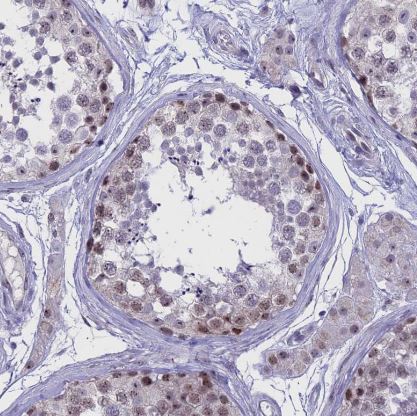 CMSS1 Antibody