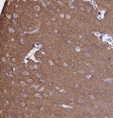 CMSS1 Antibody