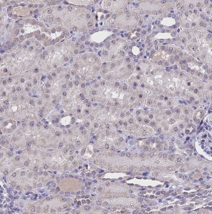 CMSS1 Antibody