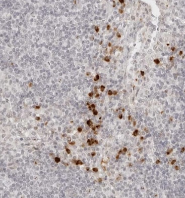 ZNF678 Antibody - BSA Free
