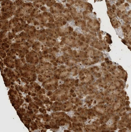 ZNF678 Antibody - BSA Free